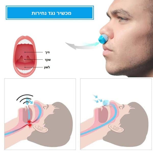 ⁦מכשיר נגד נחירות⁩ – תמונה ⁦5⁩