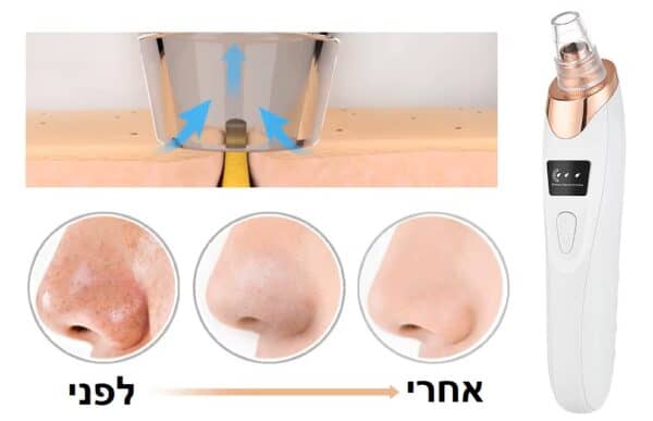 ⁦שואב שחורים מהפנים⁩ – תמונה ⁦3⁩